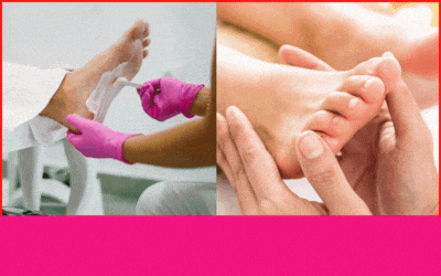 Como Remover Calos e Rachaduras dos Pés